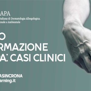 Medici e professionisti della dermatologia discutono casi clinici avanzati nel Corso SIDAPA su Casi Clinici. Un'opportunità unica per esplorare diagnosi e trattamenti attraverso approfondite analisi di situazioni reali. Accedi a esperienze pratiche e approfondimenti guidati dagli esperti del settore. Iscriviti ora e arricchisci le tue competenze in dermatopatologia.